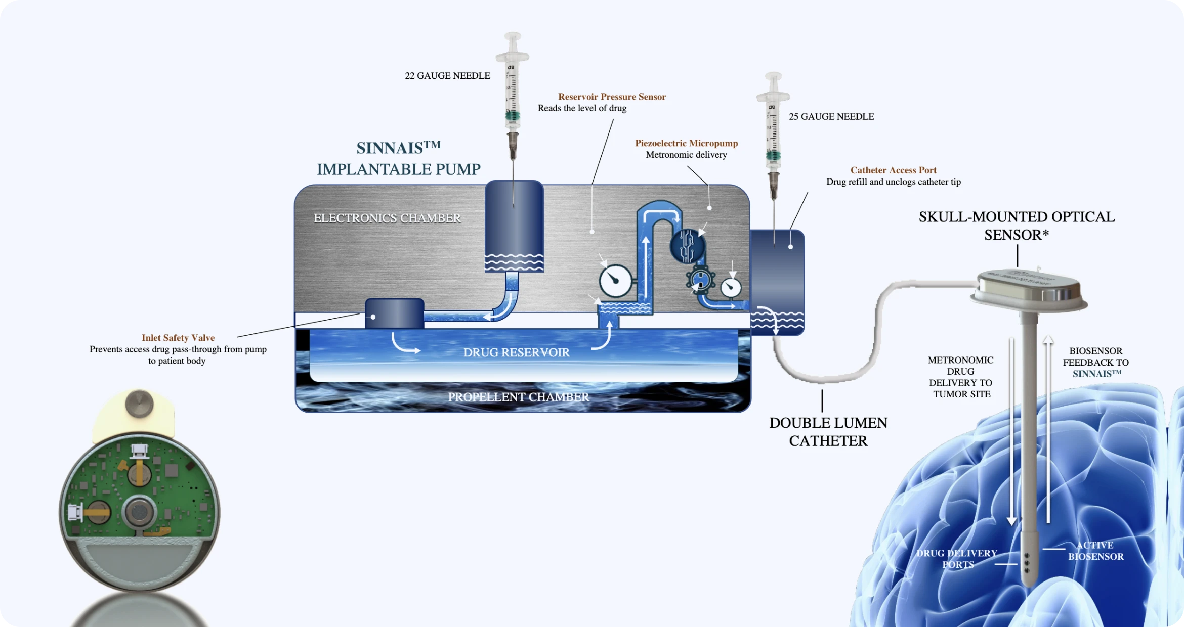 SINNAIS Implantable Pump Graphic