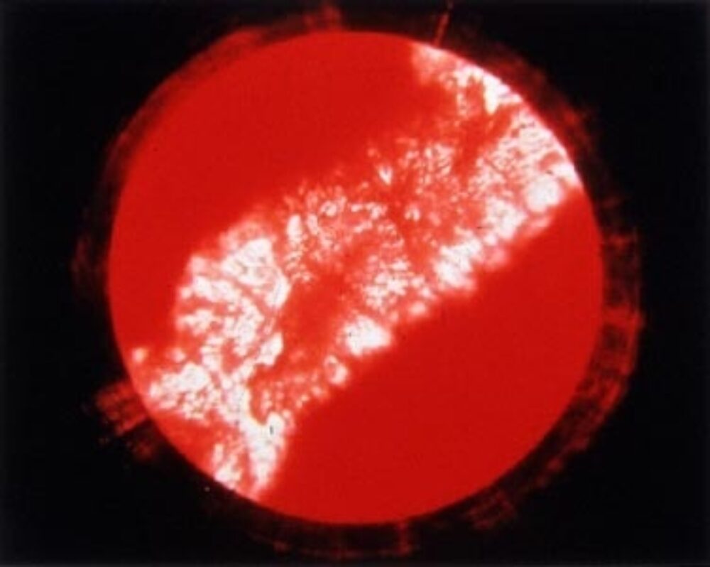 1997 R Guberman Bloodworkdetail
