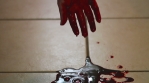 Hand dripping into blood pool