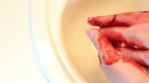 Cleaning Bloody Hands in Sink