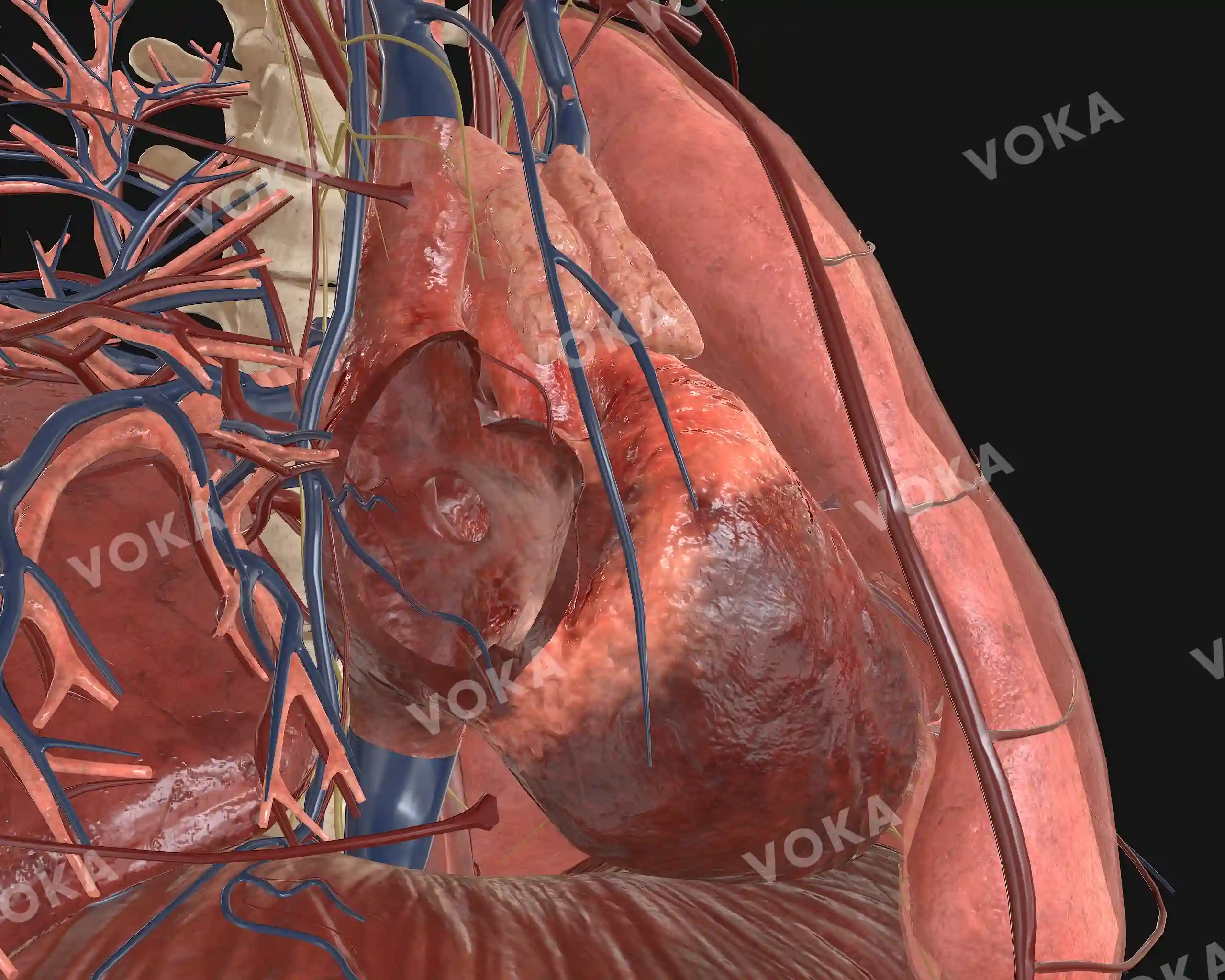 Atrial septal defect (ASD) image