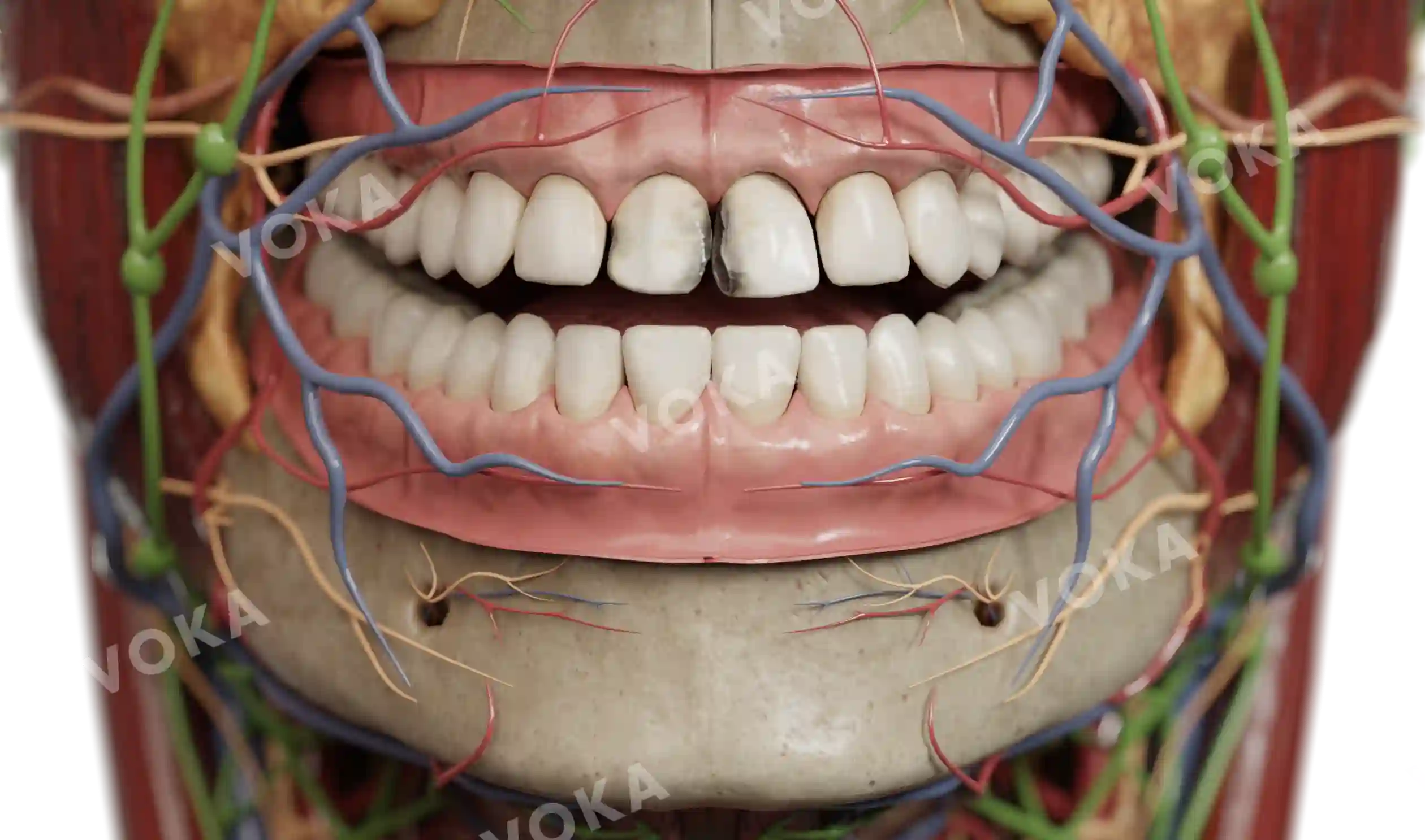 Black’s classification of tooth decay – class IV image