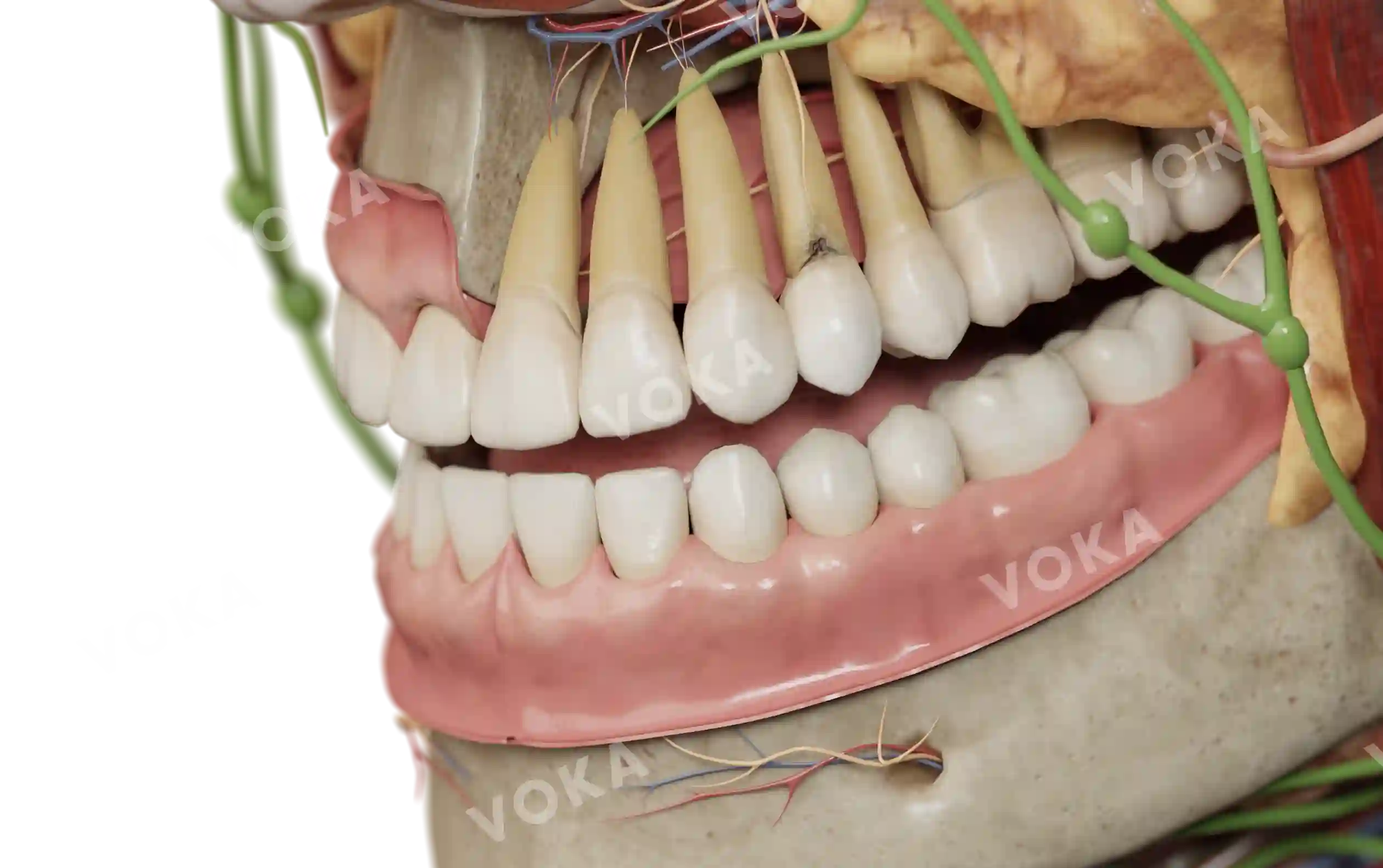 Root caries image