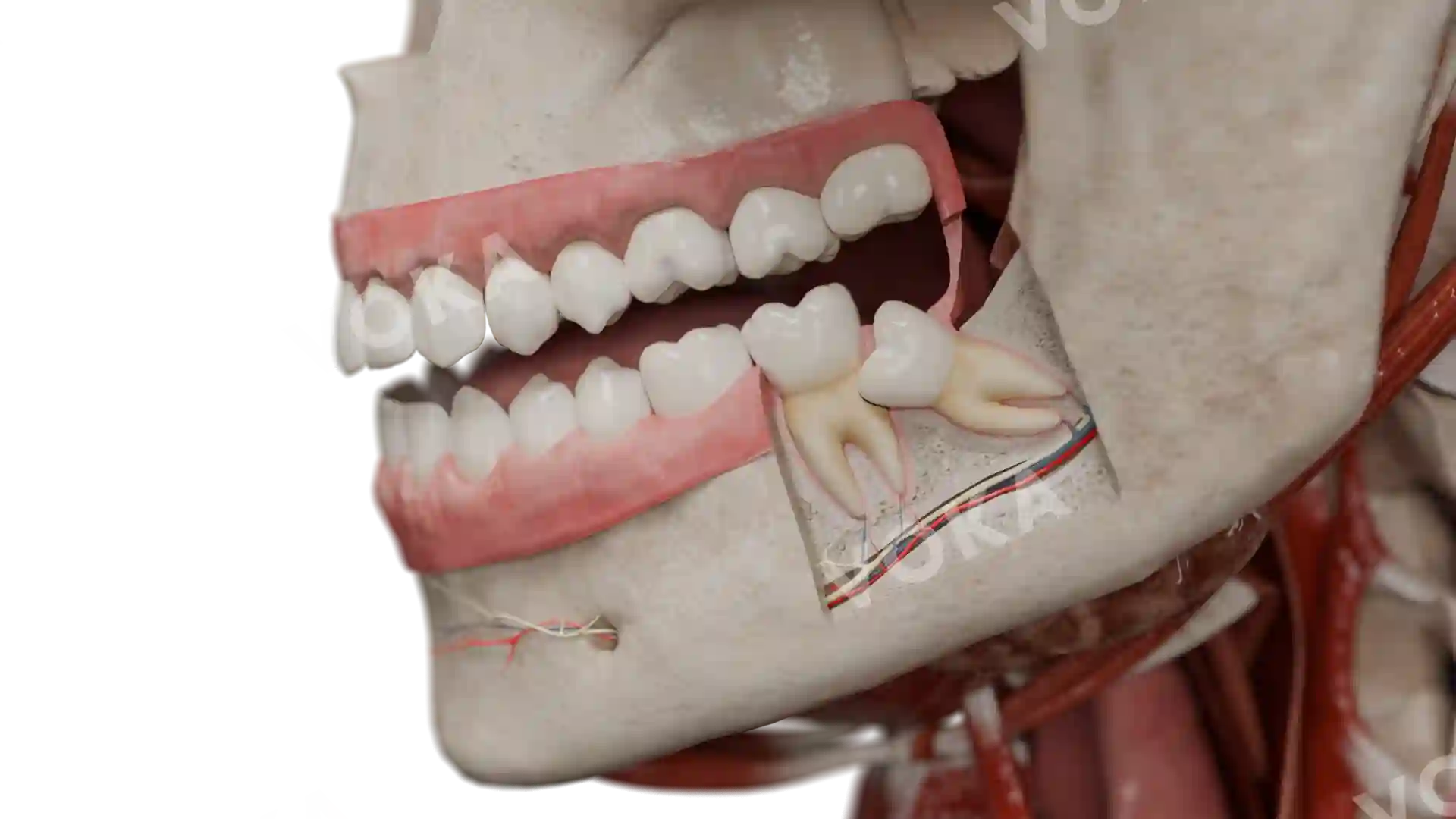 External compression resorption image