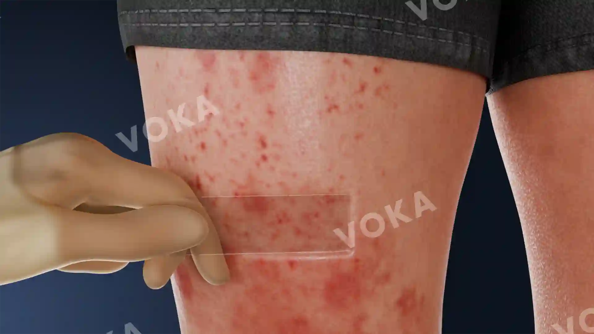 Negative diascopic test image