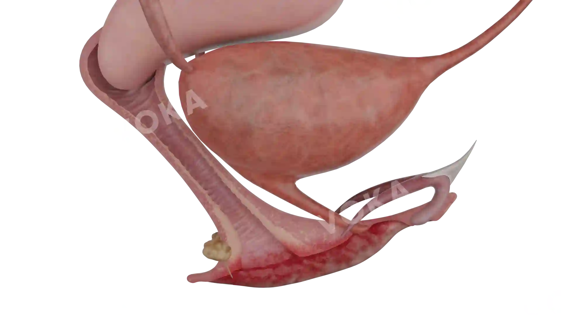 Vulvitis image