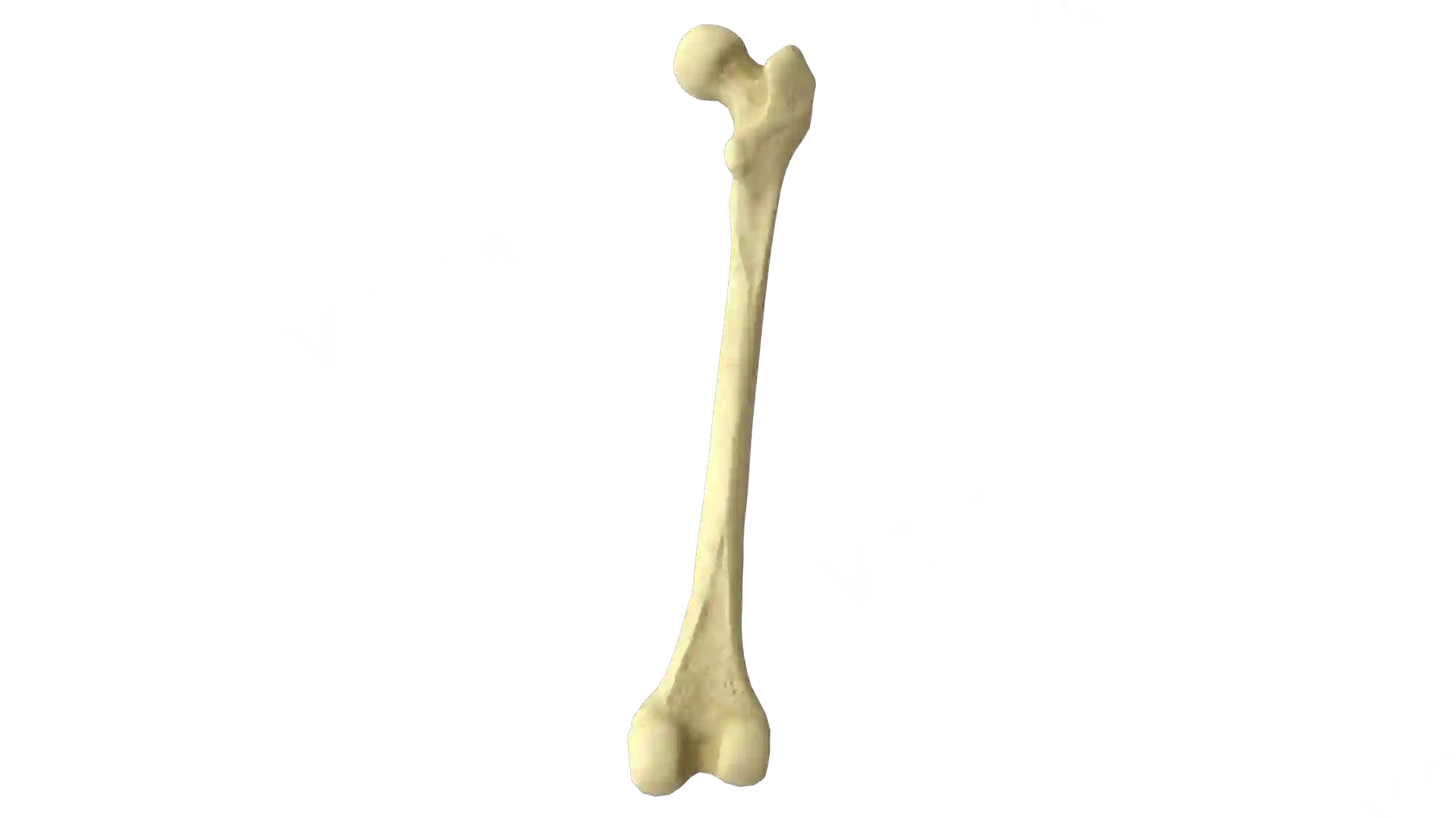 Femur right image