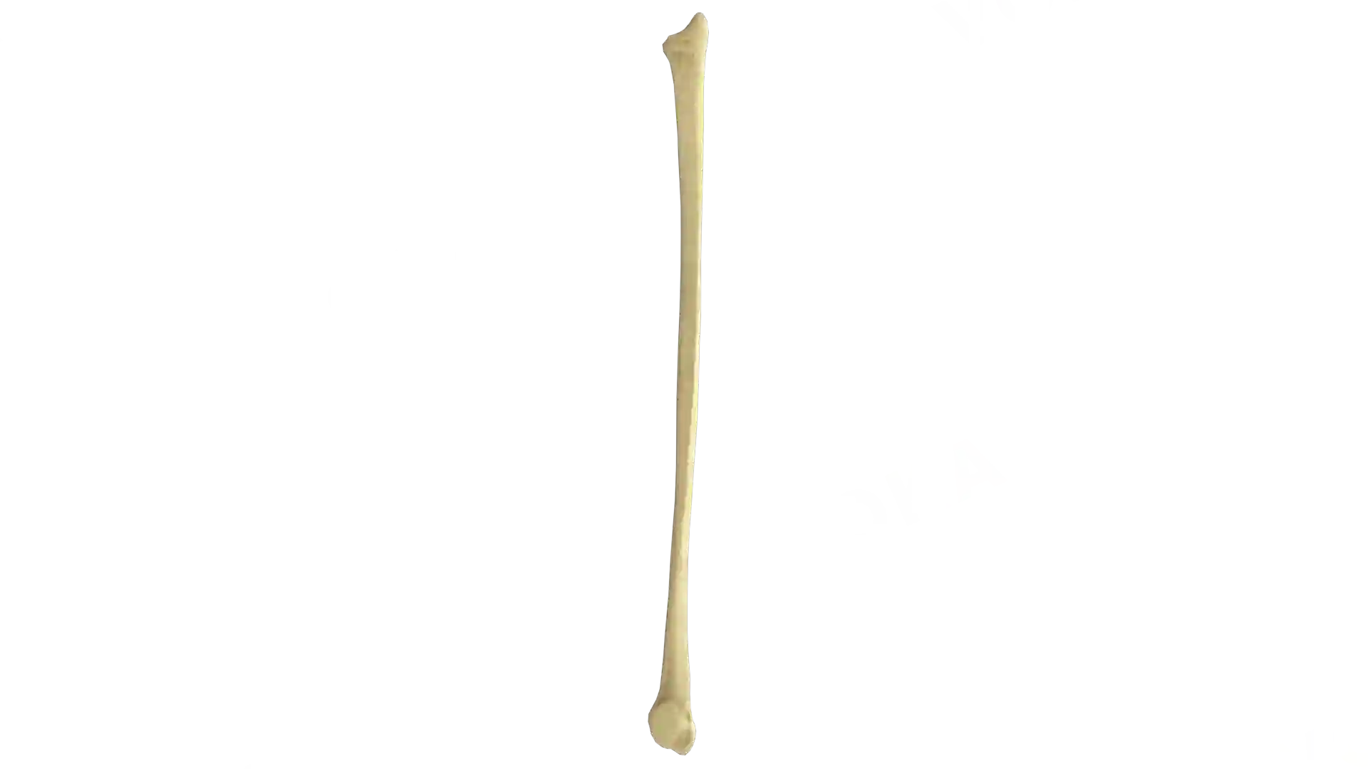 Fibula right image