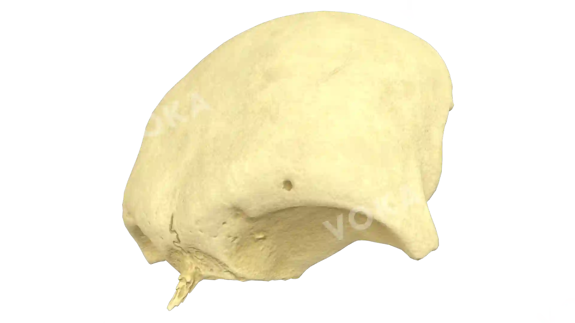 Frontal bone image