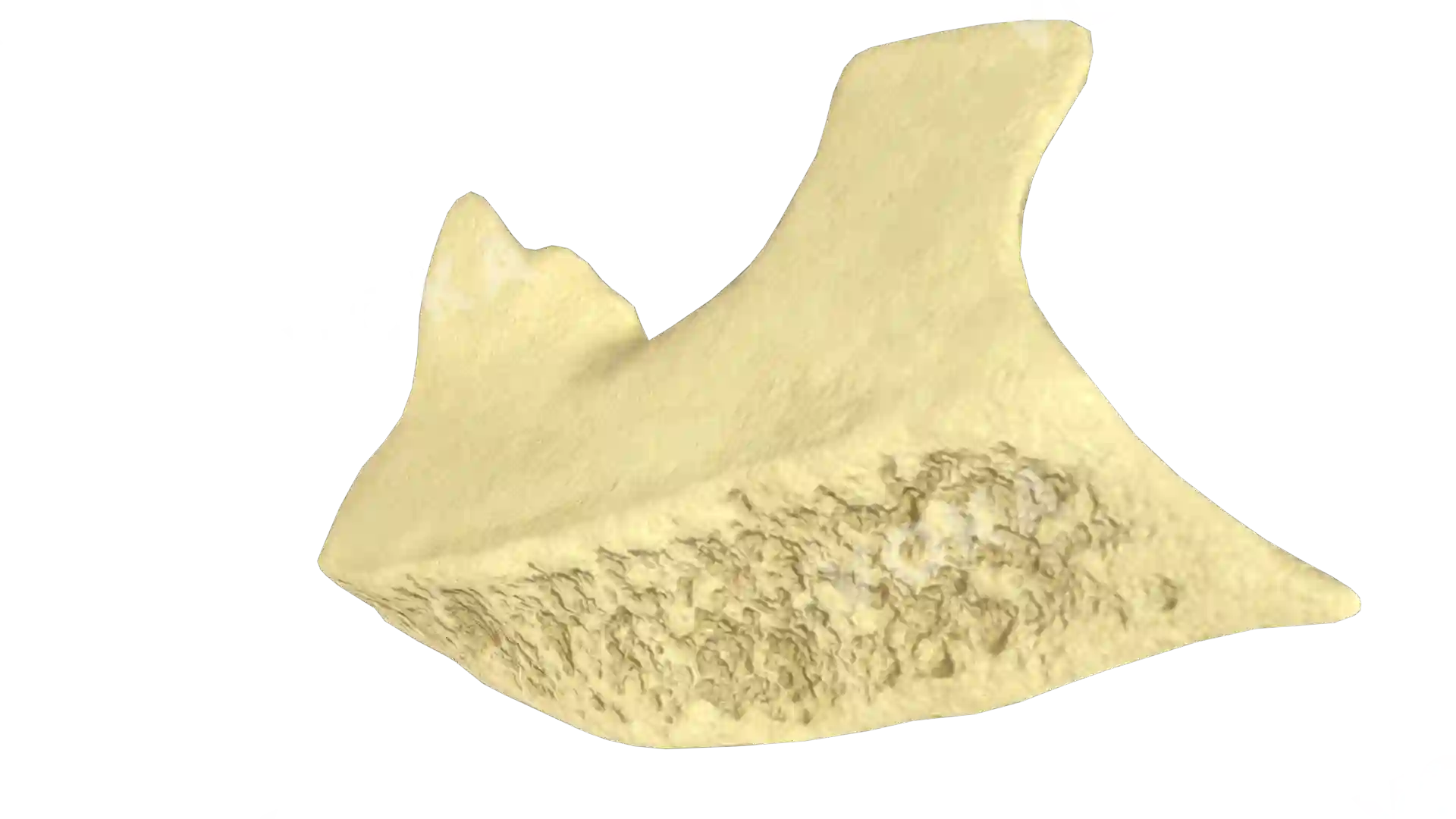 Inferior nasal turbinate left image