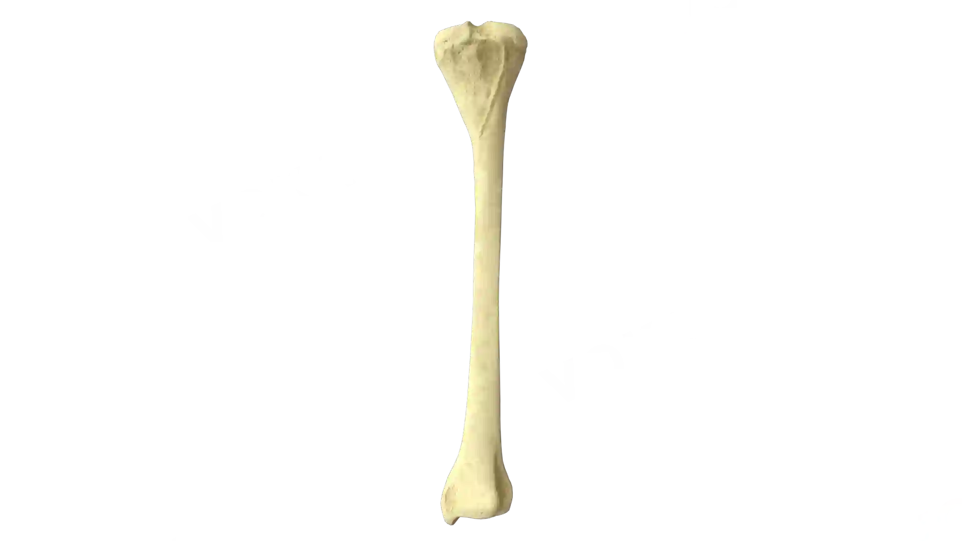Tibia right image