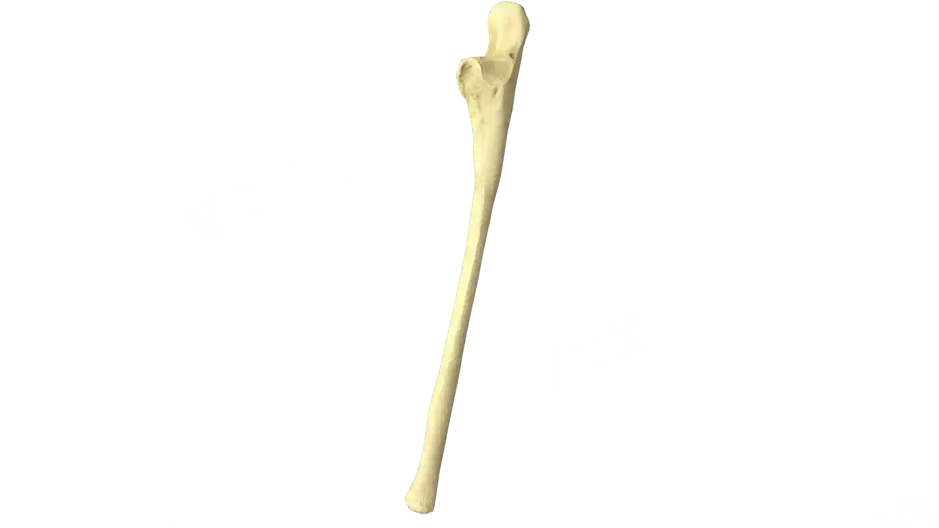 Ulna left image