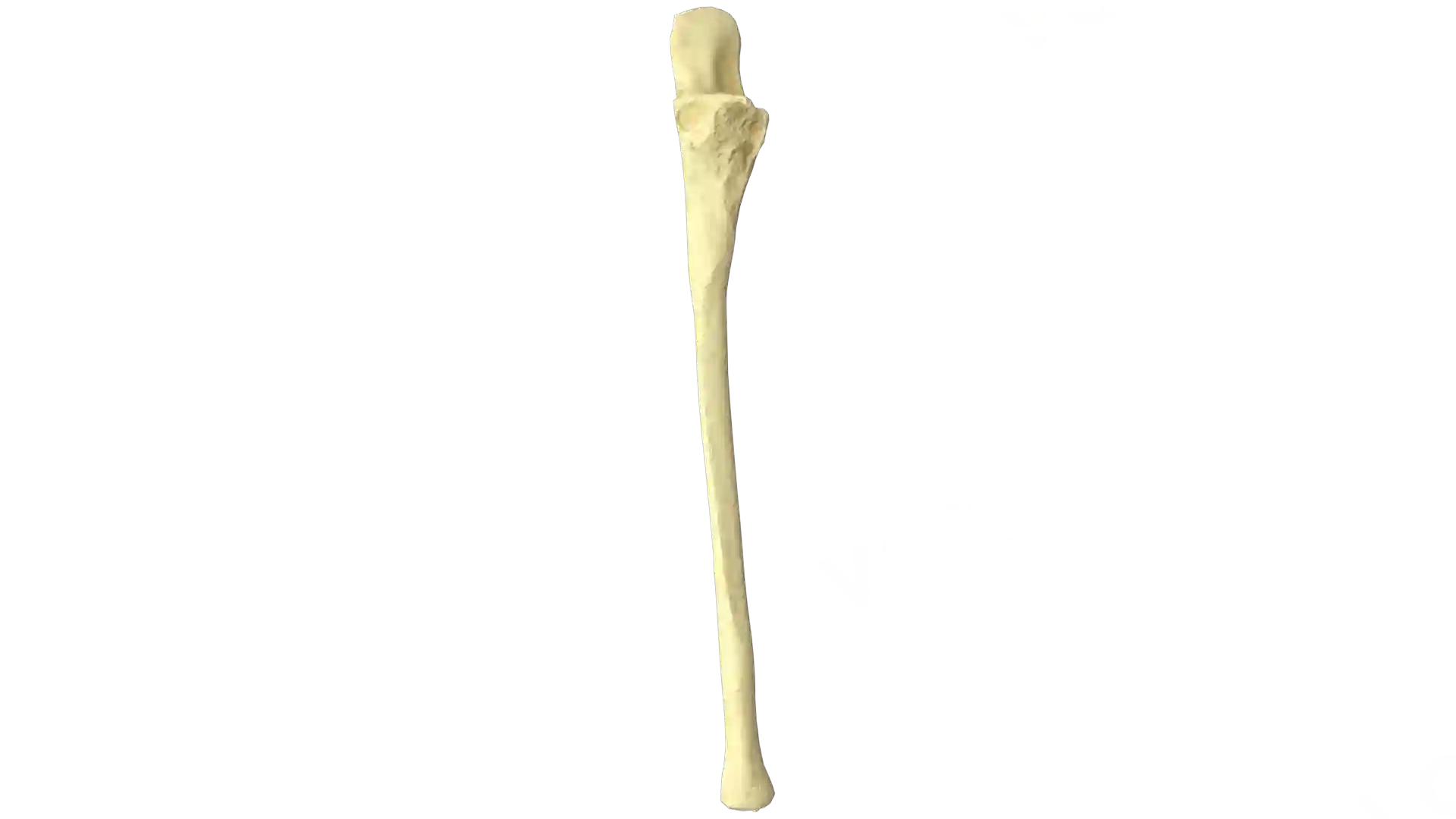 Ulna right image