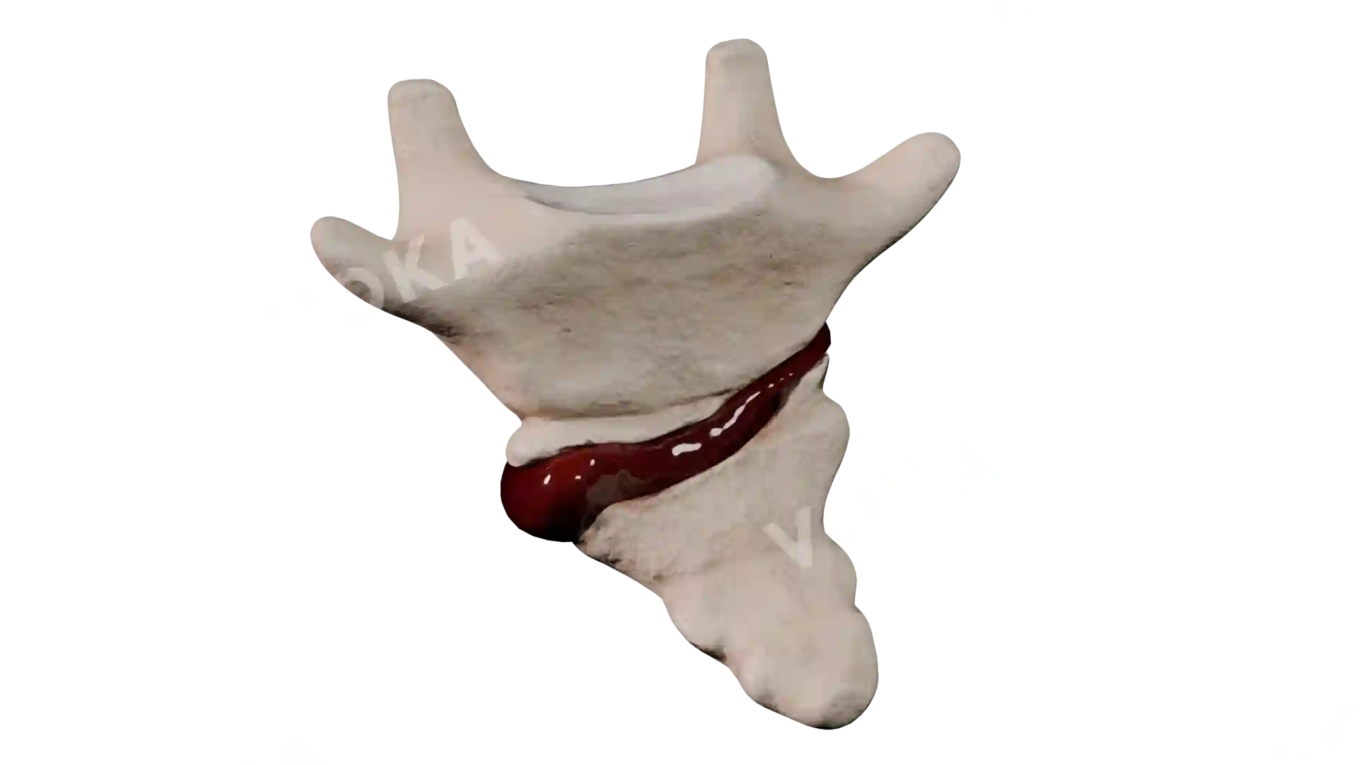 Coccyx type 1 BE1 trv image