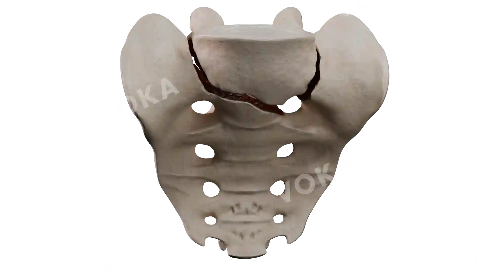 Sacrum coccyx type 5 BE5 1 trv image