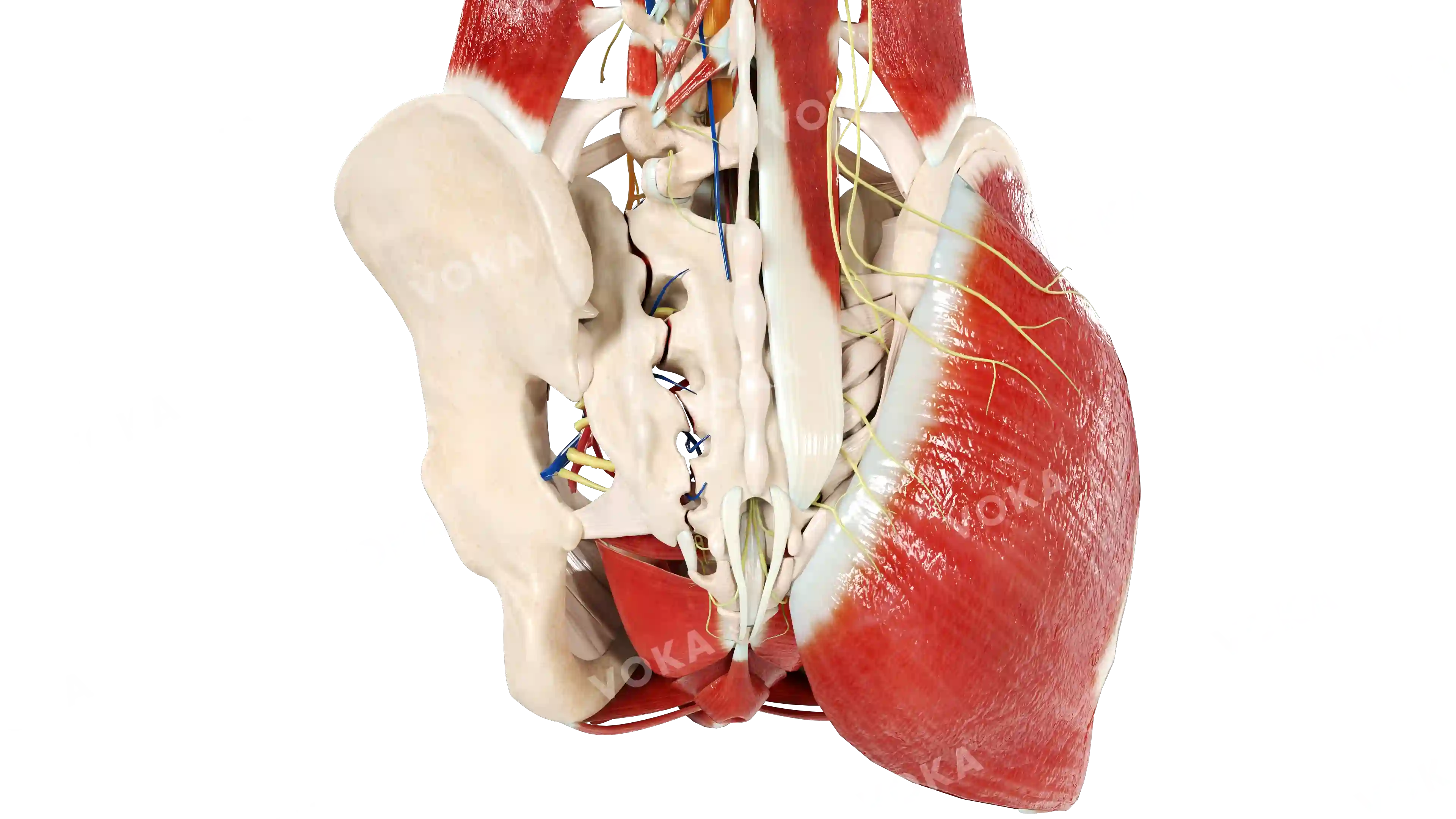 Sacrum fracture: zone 2 (Denis classification) image