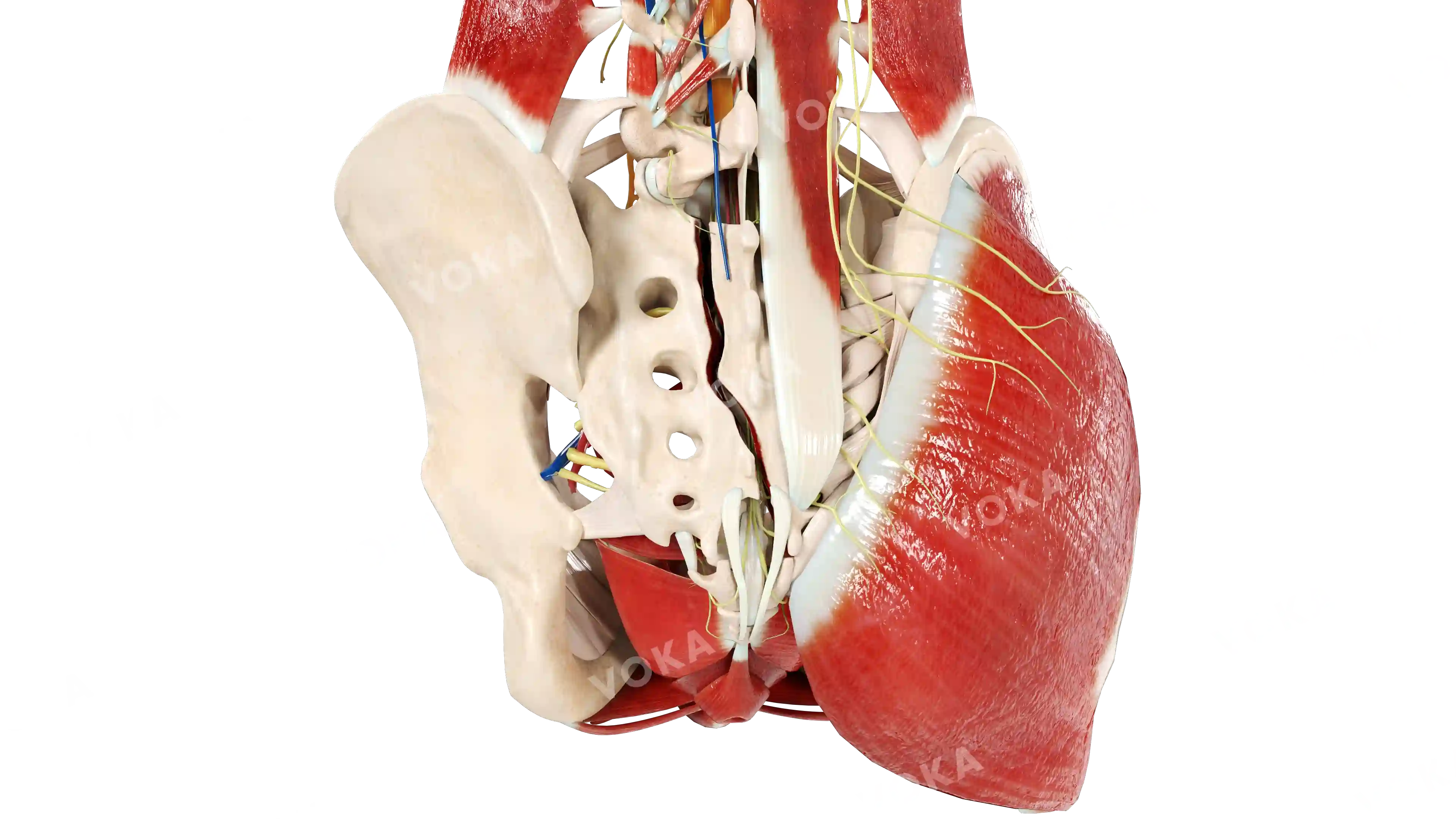 Sacrum fracture: zone 3 (Denis classification) image