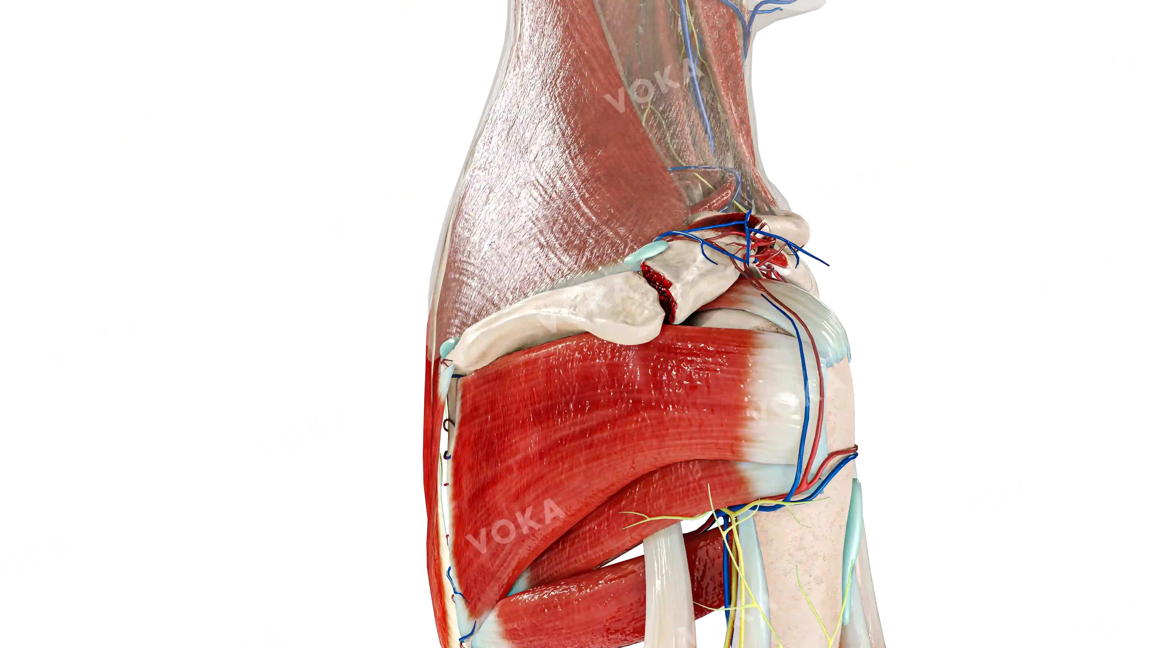 Kuhn type II acromion process fracture of the scapula image