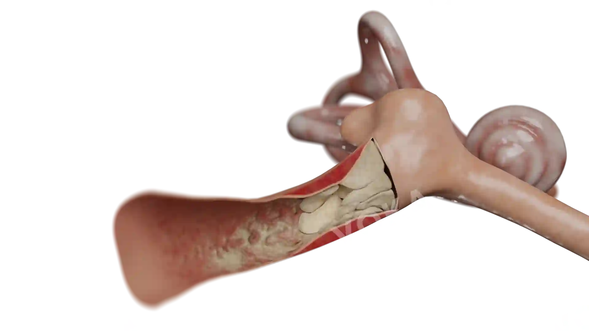 Otitis externa image