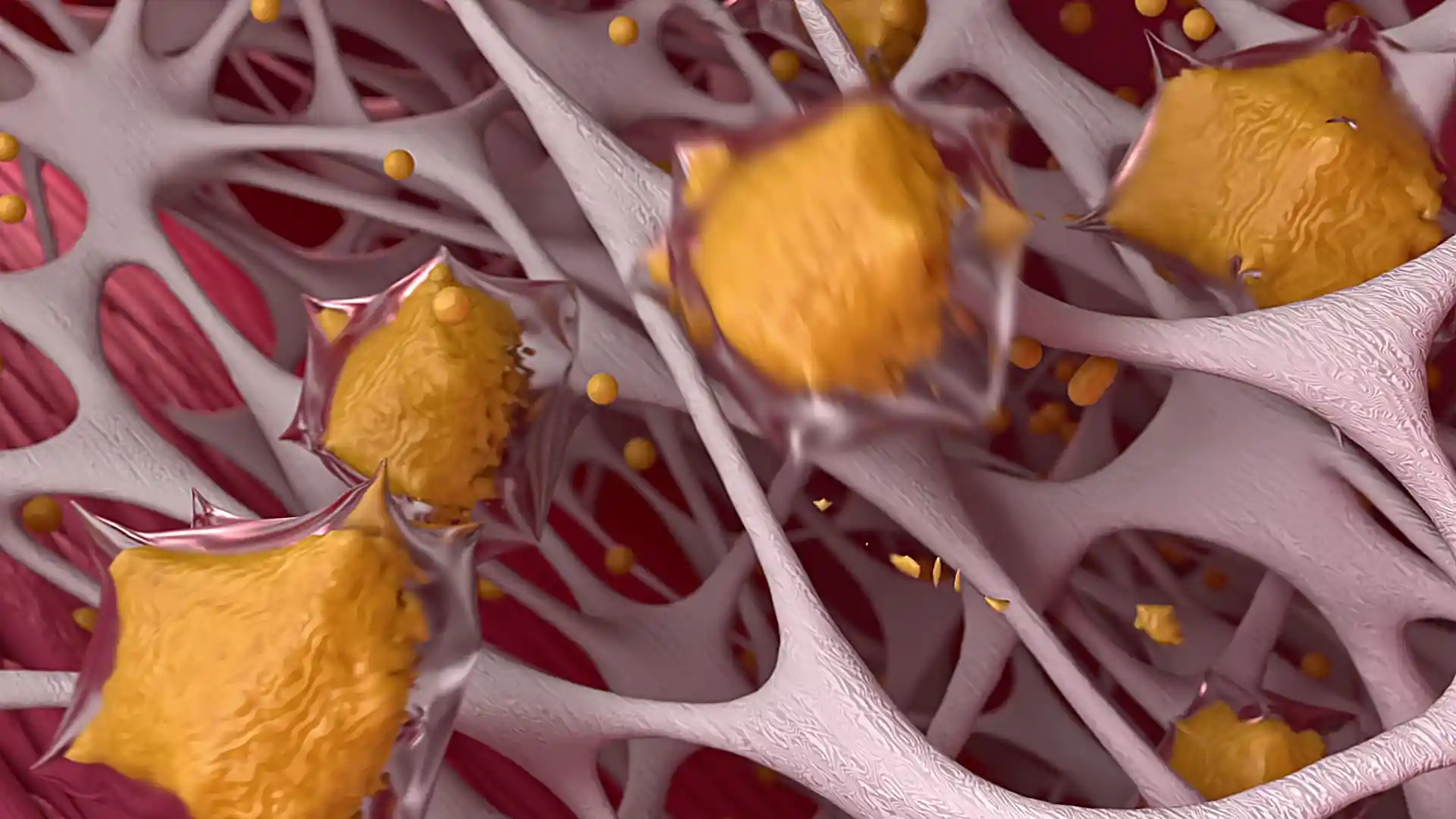 Atherosclerosis process animation