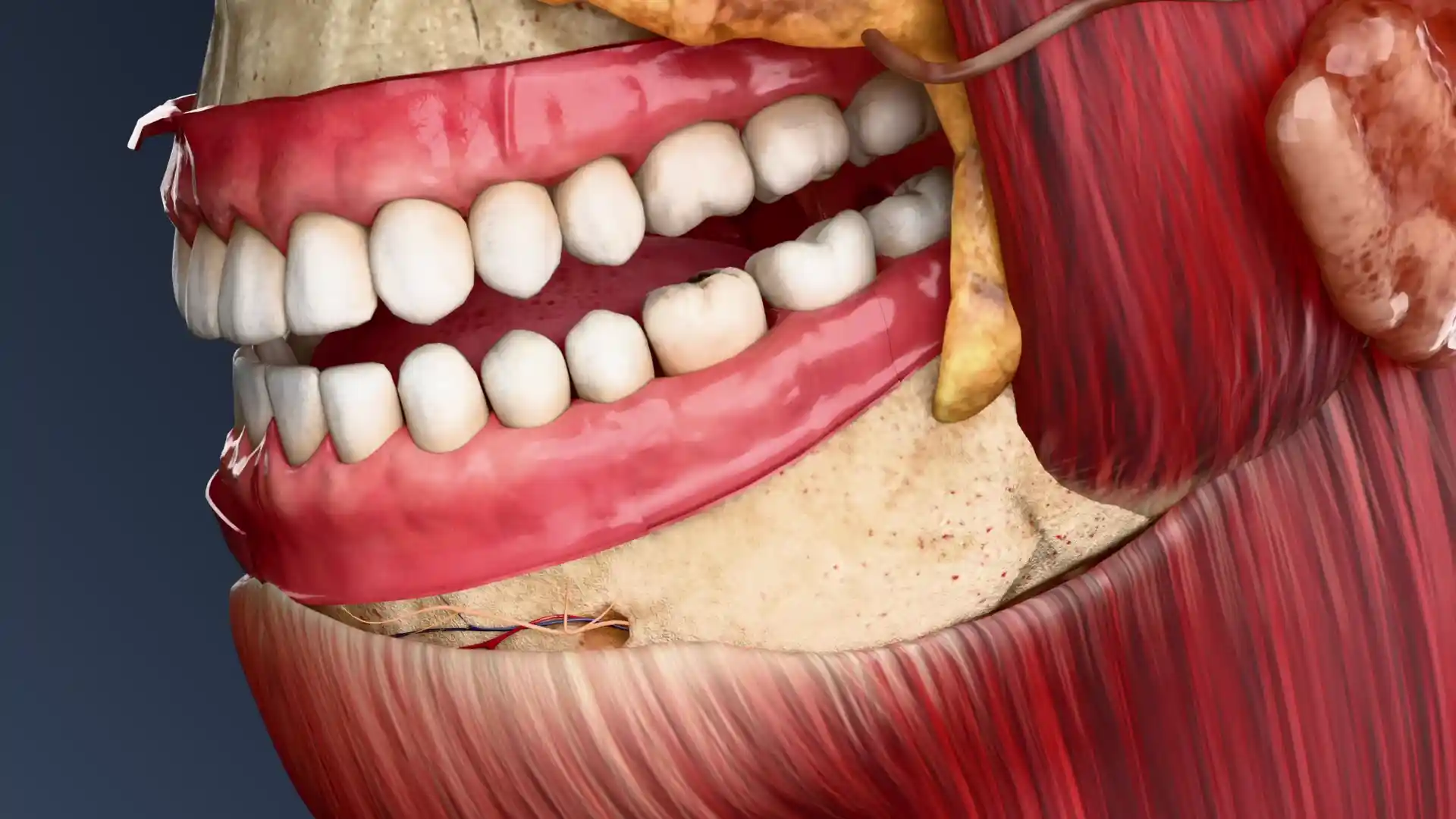 Apic pereodontit animation