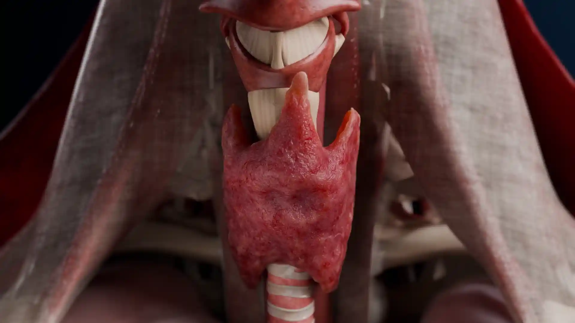 Diffuse goiter of the thyroid gland animation