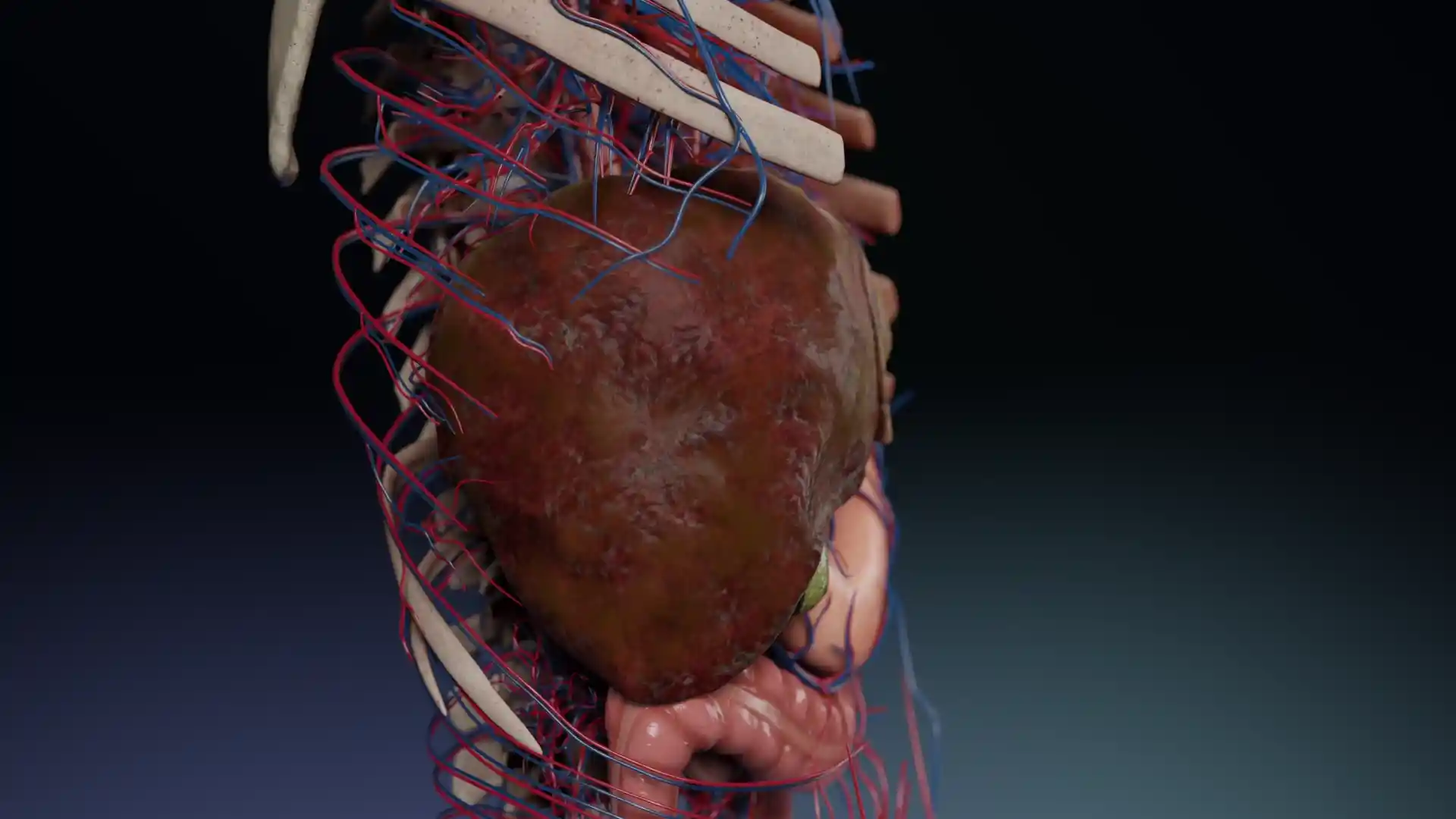 Cirrhosis animation