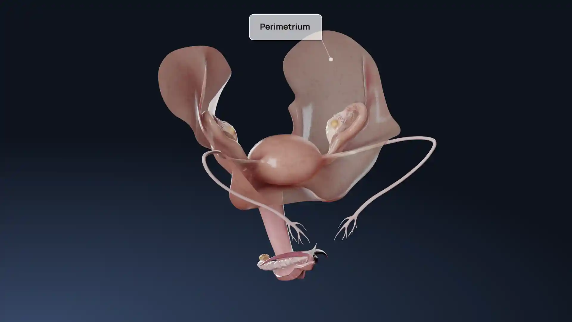 Adenomioz animation