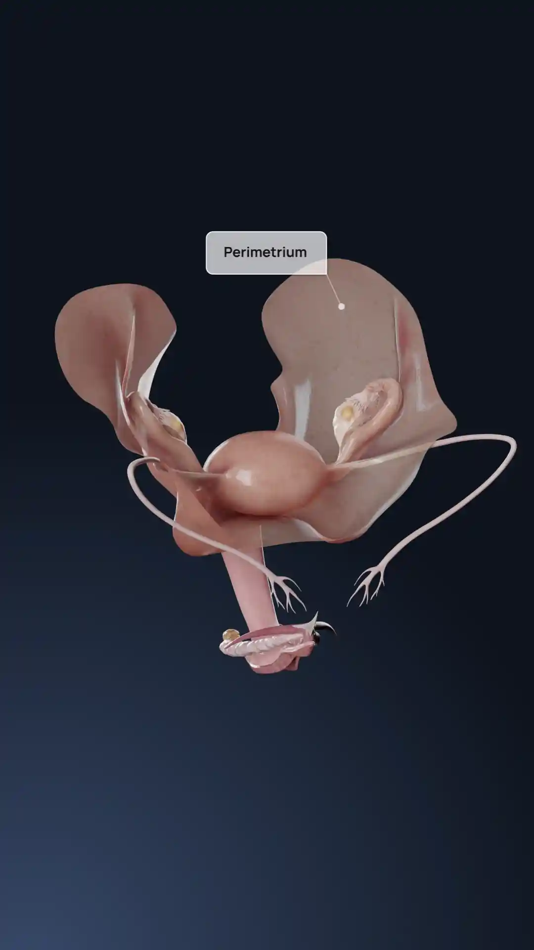 Adenomioz animation