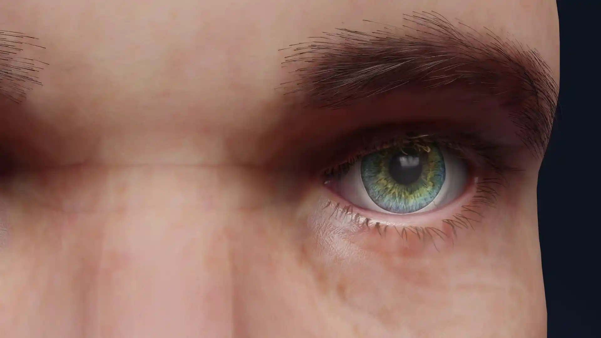 Papillary conjunctivitis animation