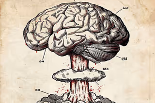 Cerebellum - ANNULATION