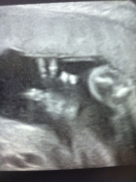 275vuwomb5313.jpg