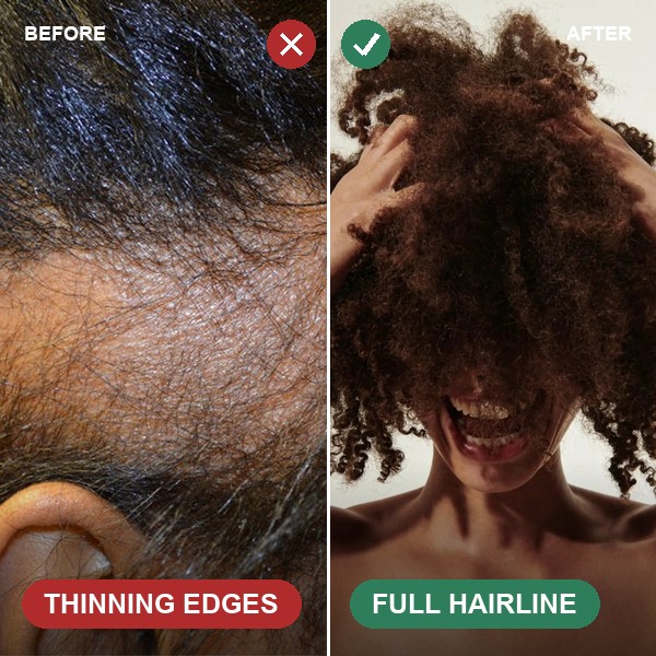 Before and after: thinning edges filled in to a full hairline