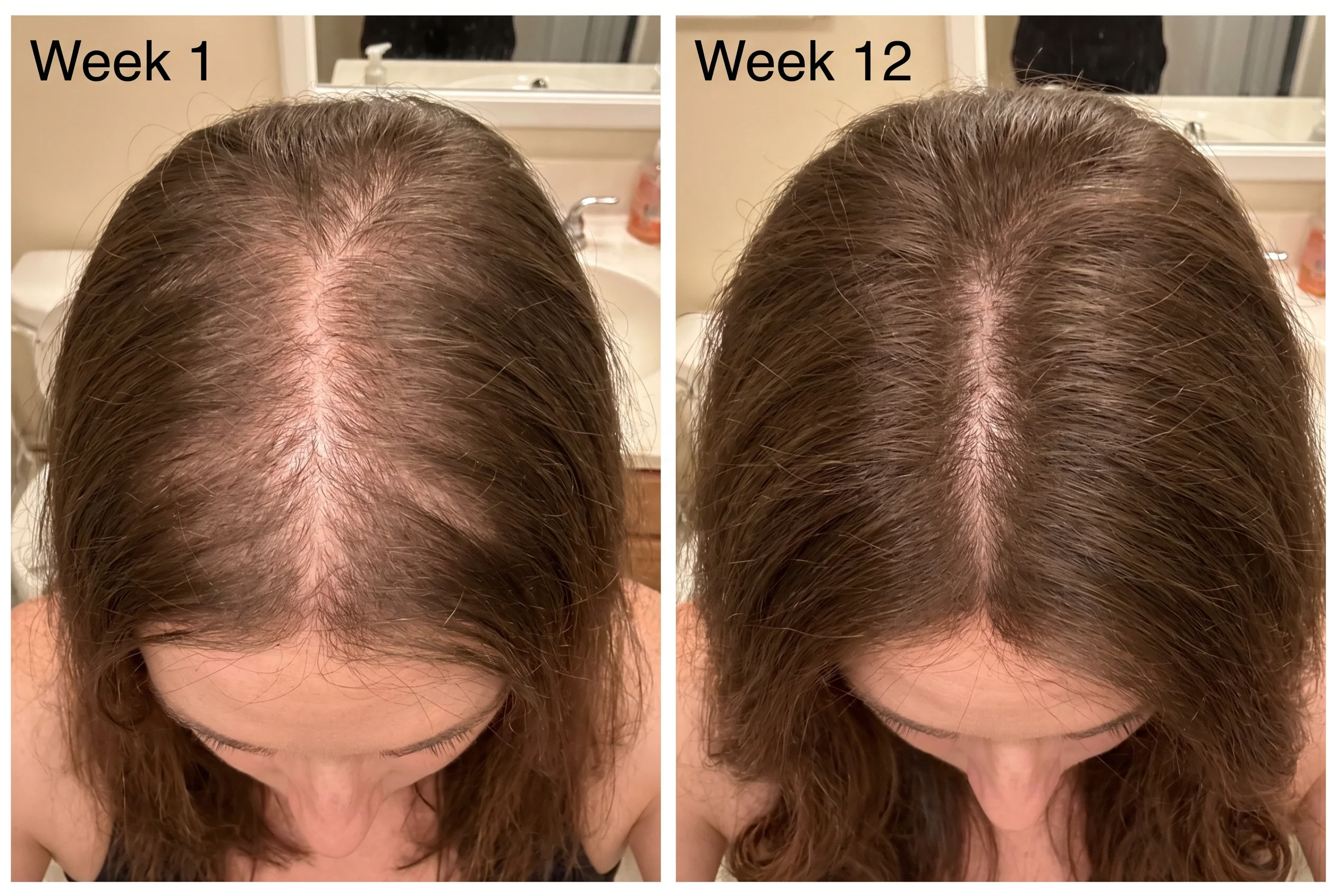 28-day Aparthy Hair Growth Roll-On customer timeline
