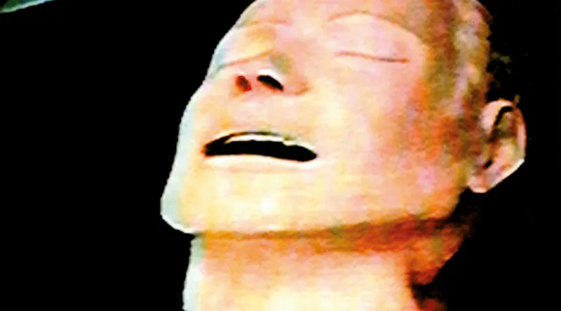 30 Years of Radiohead: The Bends