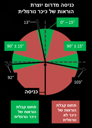 Roundabout 3 normal he.png