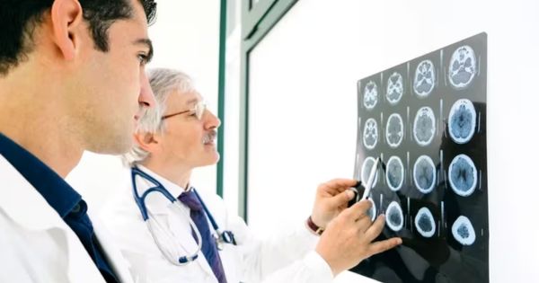 ¿Cómo saber si estoy sufriendo un accidente cerebrovascular?