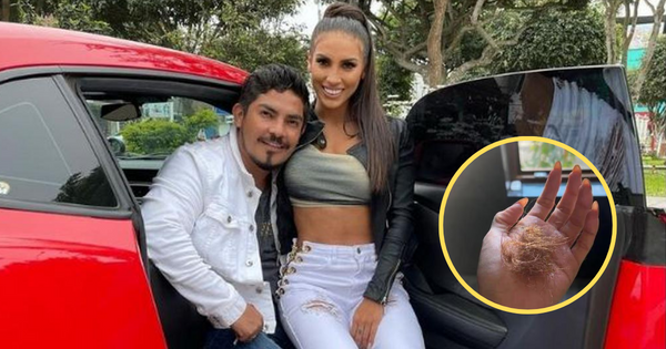 Portada: Allison Pastor, esposa de Erick Elera, revela en sus redes sociales la enfermedad que sufre