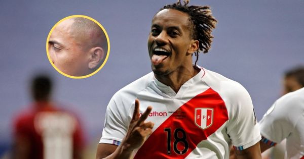 Portada: André Carrillo teme regresar a Alianza Lima: "Que no me pase lo que le pasó a Cueva. No quiero estar con el ojo hinchado"