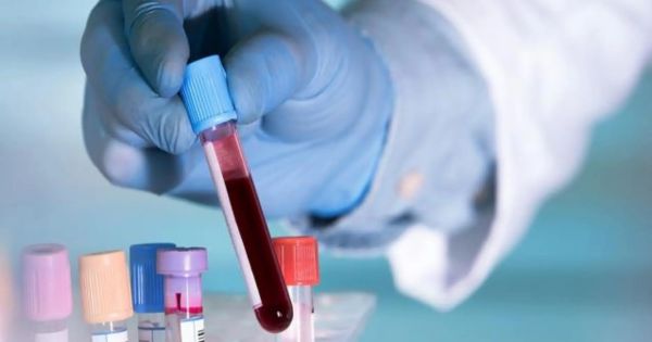 Un nuevo test de sangre permite detectar con antelación el alzhéimer, según estudio científico