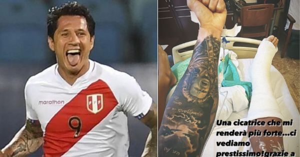 Portada: Gianluca Lapadula se pronunció tras ser operado: "Una cicatriz que me hará más fuerte"