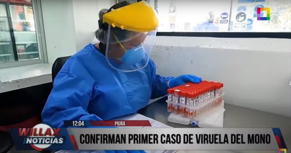 Portada: Viruela del mono: detectan primer caso en Piura en lo que va de 2024