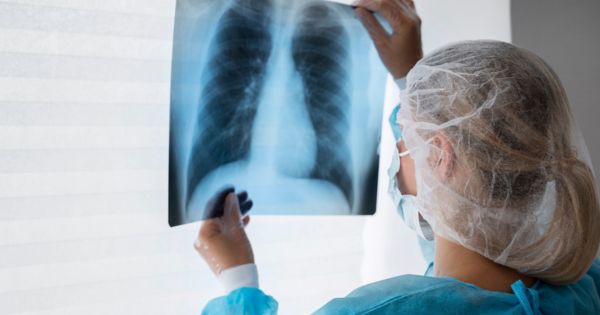 Cáncer de pulmón: conozca los signos para estar alerta y prevenir esta enfermedad
