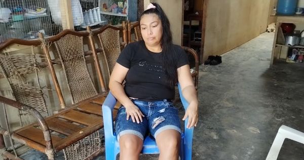 Loreto: diagnostican a mujer con enfermedad que le hace sudar sangre