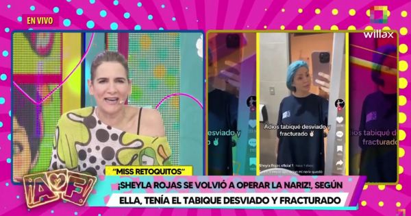 Gigi Mitre sobre operación de Sheyla Rojas: "No hay que normalizar este tipo de excesos"