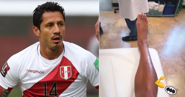 Gianluca Lapadula mostró cómo quedó su tobillo tras ser operado (VIDEO)