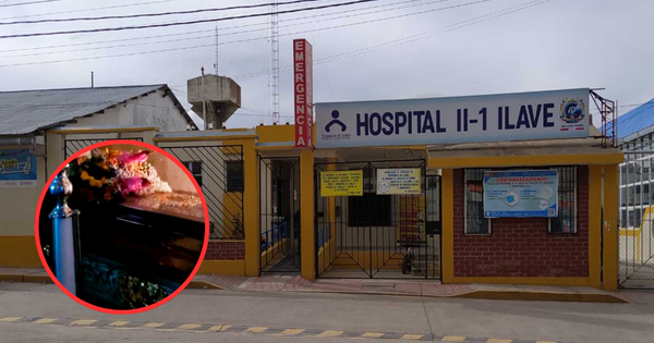 Puno: madre fallece por complicaciones en operación por cesárea