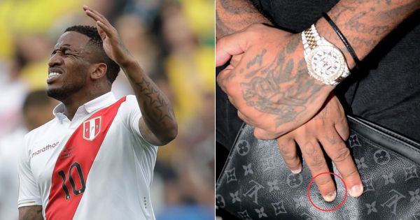 Portada: Jefferson Farfán luce un extraño aspecto en su dedo e internautas reaccionan: "¿Es un hongo?"