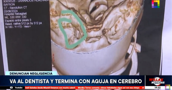 Portada: VMT: menor asiste a una consulta dental y termina con una aguja en el cerebro