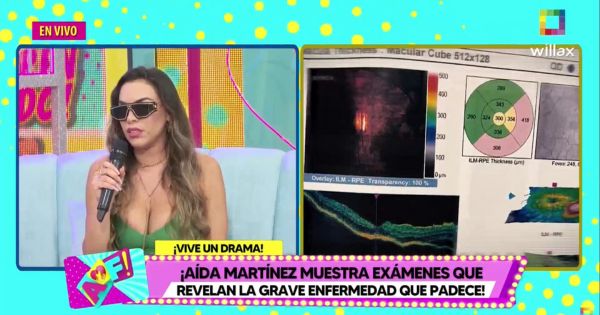 Portada: Aída Martínez muestra exámenes que confirman su enfermedad: "Con un ojo veo un 30% y con el otro 50%"